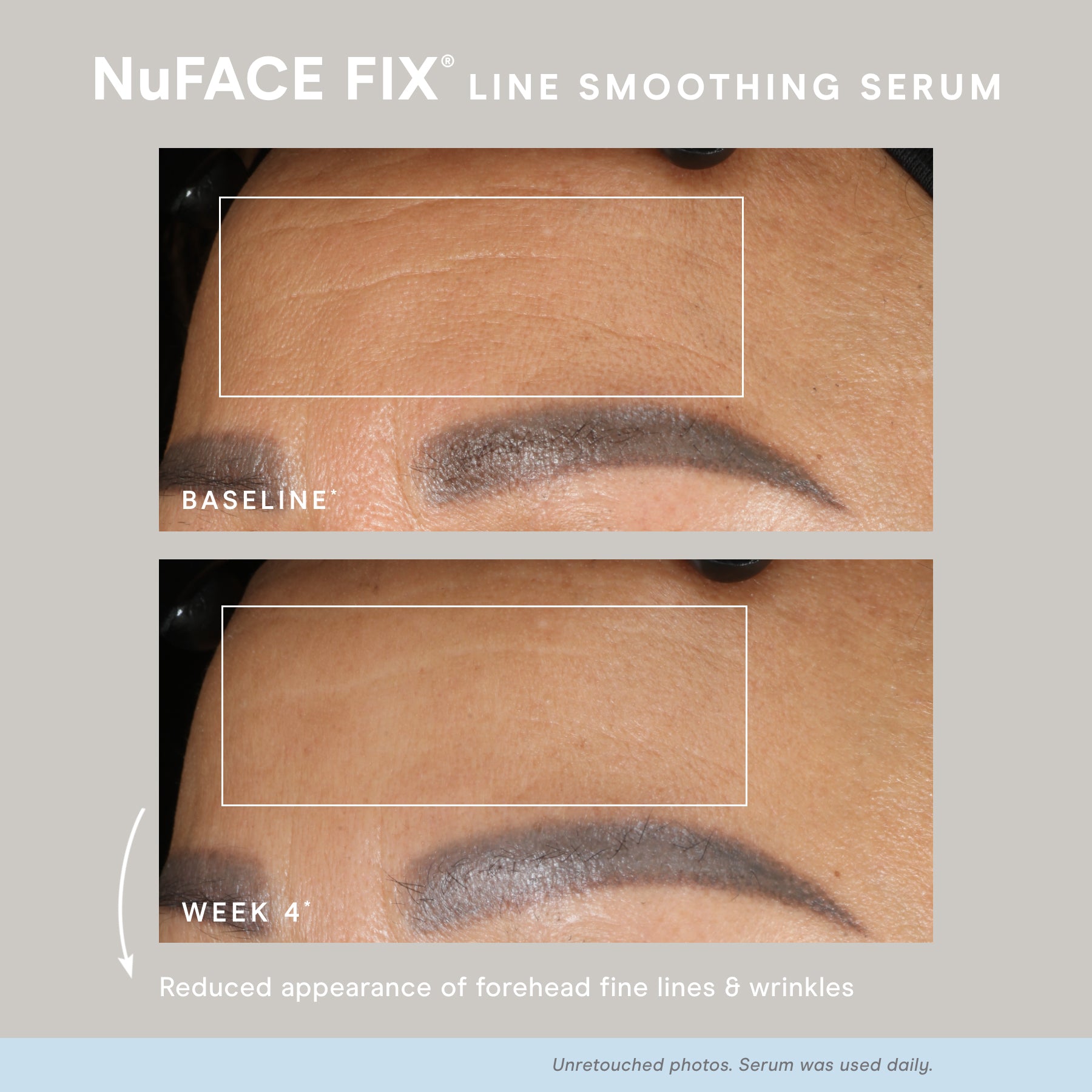 NuFACE FIX® Serum con Péptidos
