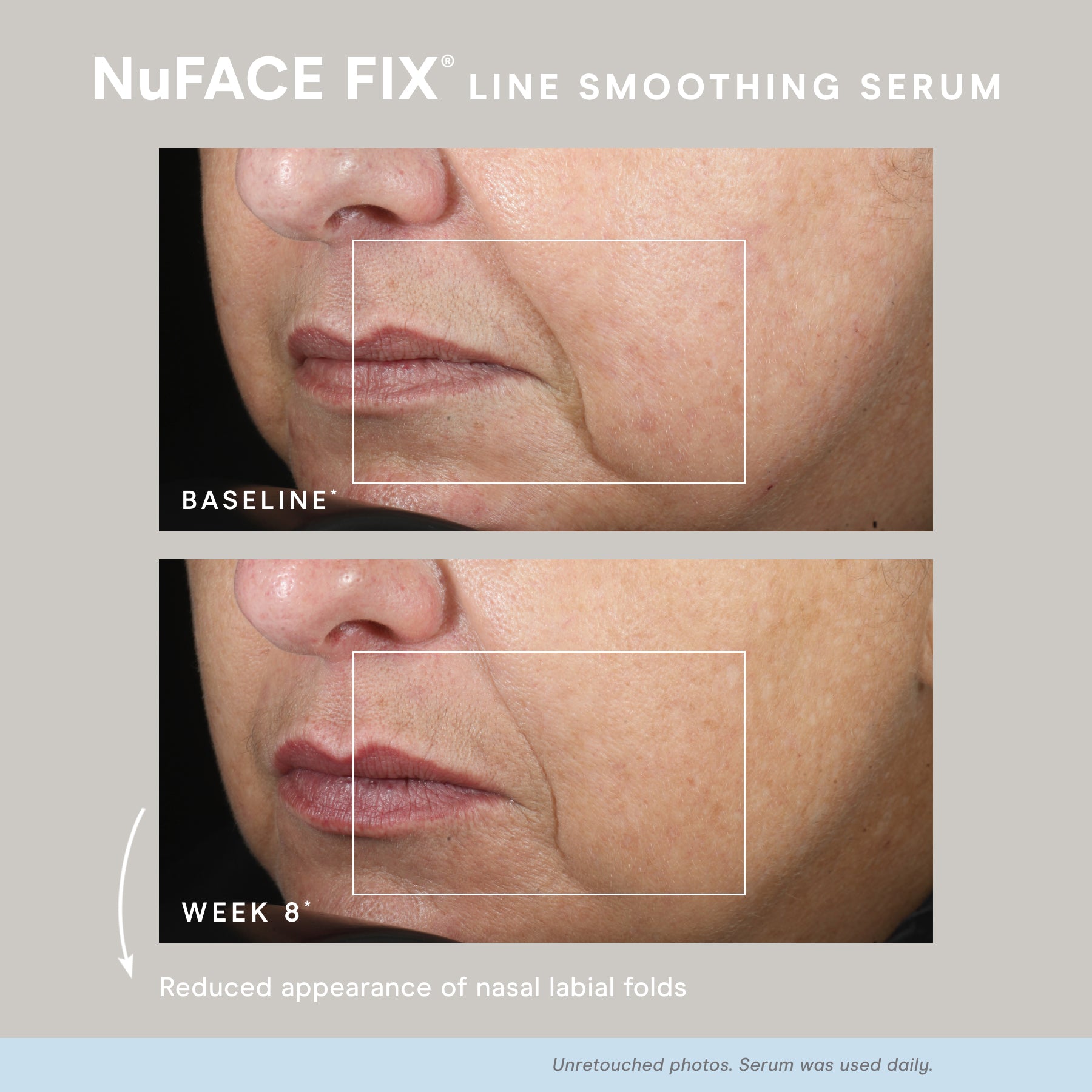 NuFACE FIX® Serum con Péptidos
